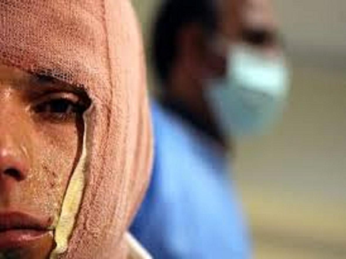 انفجار مواد محترقه درالیگودرز 2 نفر را مصدوم کرد انفجار مواد محترقه درالیگودرز 2 نفر را مصدوم کرد